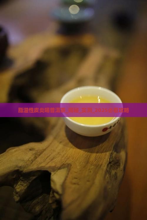 脂溢性皮炎喝普洱茶 脂溢性皮炎喝普洱茶