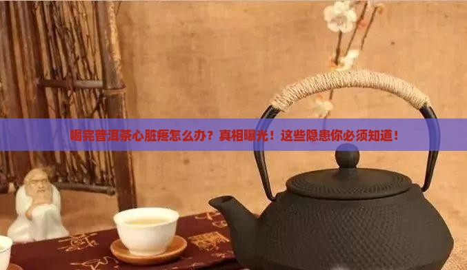 喝完普洱茶心脏疼怎么办