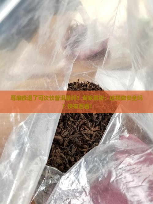 荨麻疹退了可次饮普洱茶吗