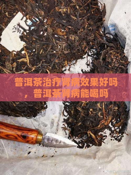 普洱茶治疗肾病