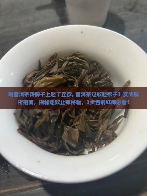 喝普洱茶饼脖子上起了丘疹