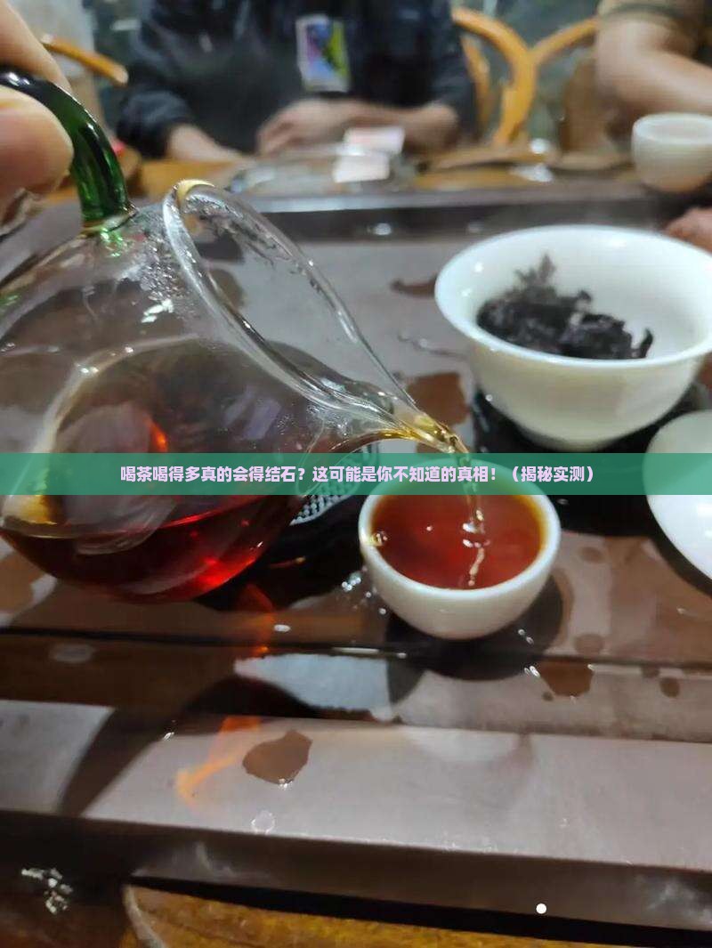 喝茶喝得多容易得结石吗