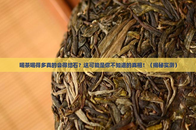喝茶喝得多容易得结石吗