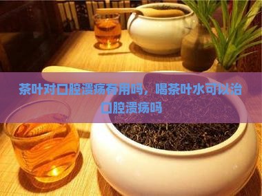 茶叶对口腔溃疡有用吗