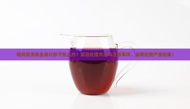 喝完普洱茶全身红疹子怎么办 喝完普洱茶全身红疹子怎么办