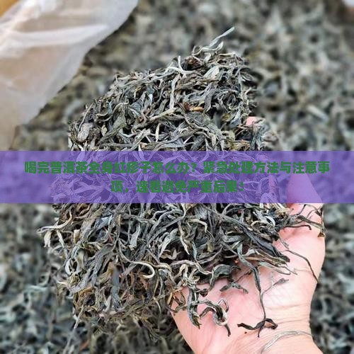 喝完普洱茶全身红疹子怎么办 喝完普洱茶全身红疹子怎么办