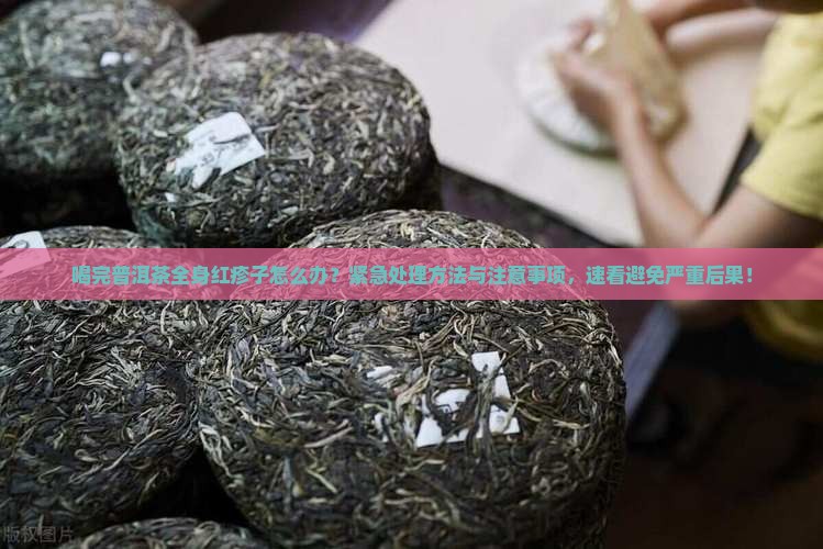 喝完普洱茶全身红疹子怎么办 喝完普洱茶全身红疹子怎么办