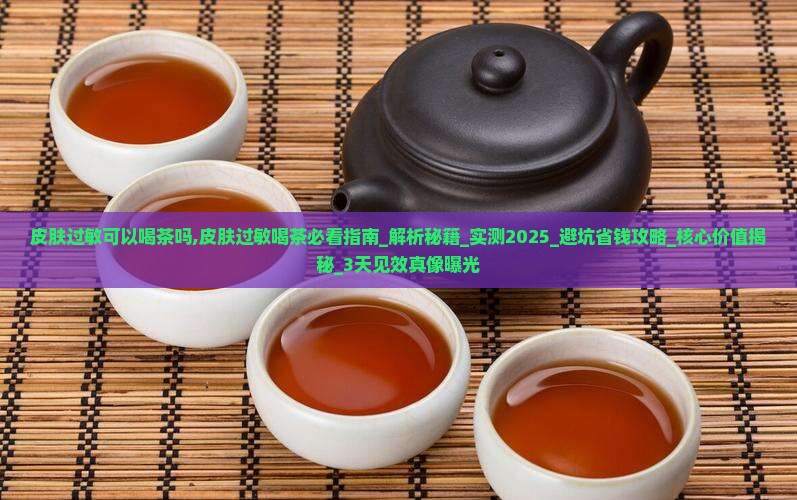 皮肤过敏可以喝茶吗 皮肤过敏可以喝茶吗