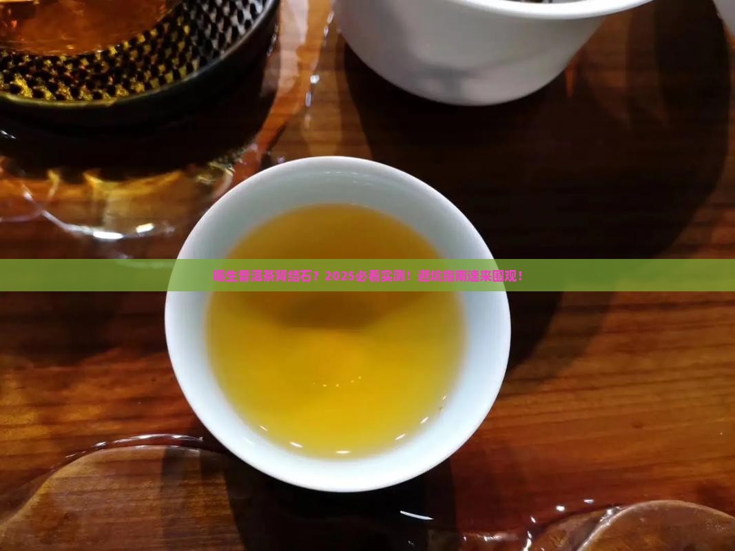 喝生普洱茶产生肾结石
