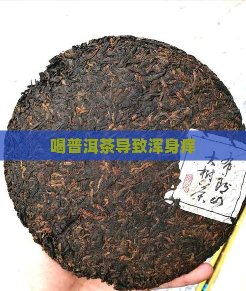 喝普洱茶导致浑身痒
