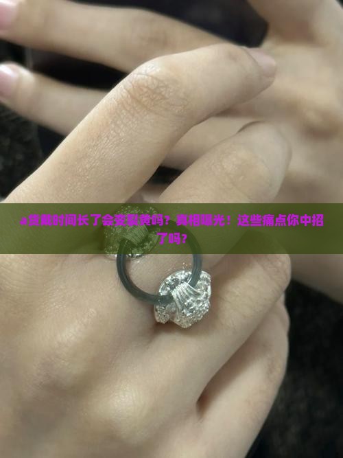 a货戴时间长了会变裂黄吗