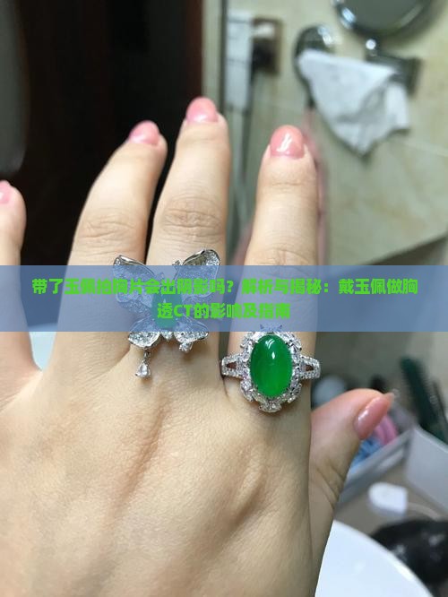 带了玉佩拍胸片会出阴影吗