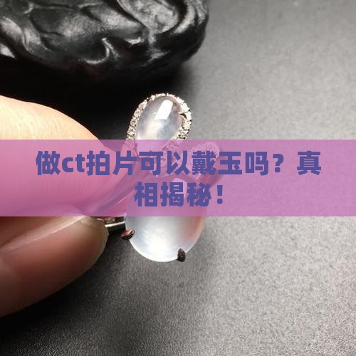 做ct拍片可以戴玉吗